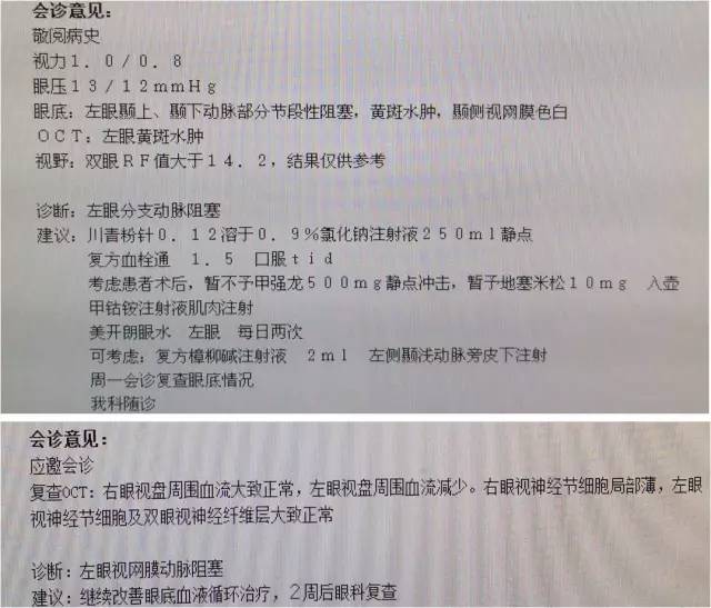 天坛医院住院日记,颈内动脉c5到c7段狭窄微创手术