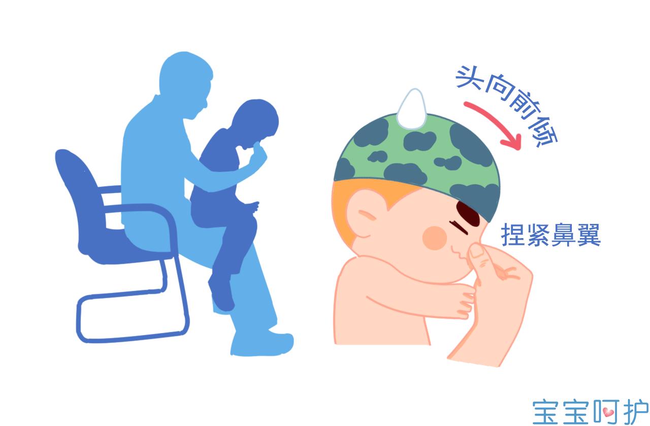 宝宝眼屎多专家解答,宝宝这几天眼屎多是上火吗