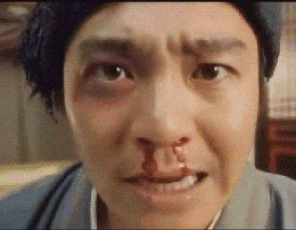 痰中带血不是鲜血有危险吗,痰中带血也不一定是肺癌