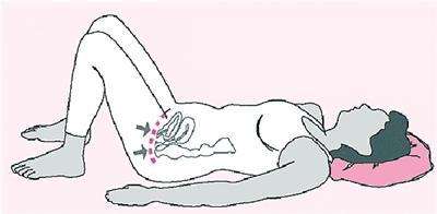 骨科术后渗液处理,骨科术后水肿会持续多长时间