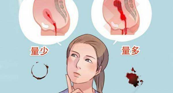 女人月经量少而且黑吃什么食补,女人月经量少发黑怎么调理