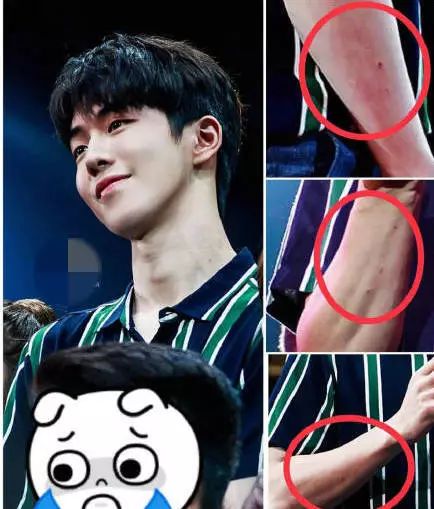 李宇春参加节目被粉丝亲,李宇春被粉丝吻是什么节目