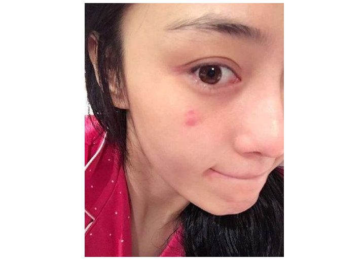 你的豆豆有救了!这瓶不到200块的德倍护万用水“去豆神奇”,我替你先试了!