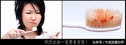 牙周博士,牙周科普访谈