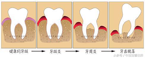 牙周博士,牙周科普访谈