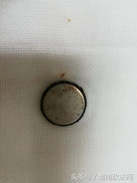 2岁宝宝误吞纽扣电池多久有反应,小孩误吞纽扣电池致喉咙腐蚀