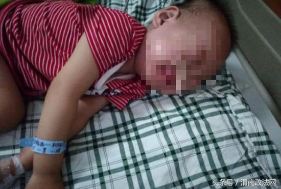 2岁宝宝误吞纽扣电池多久有反应,小孩误吞纽扣电池致喉咙腐蚀