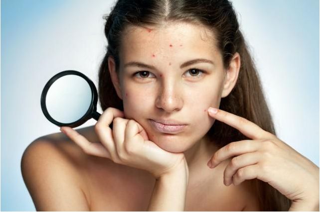 青春痘伤疤怎么修复,青春痘时间长疤痕修复的最佳方法