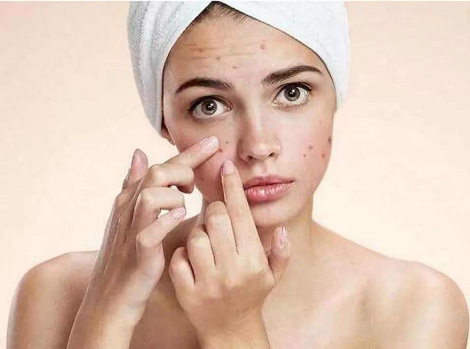 青春痘伤疤怎么修复,青春痘时间长疤痕修复的最佳方法