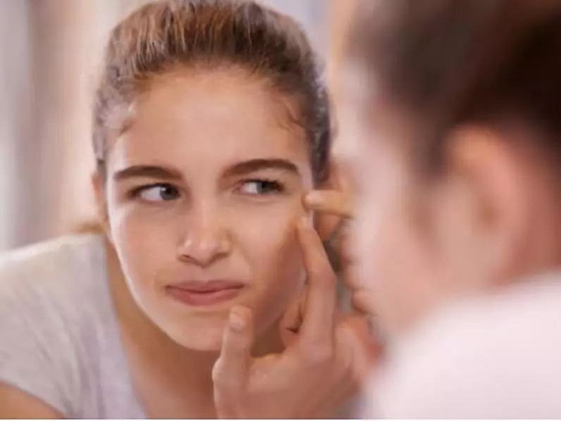 青春痘伤疤怎么修复,青春痘时间长疤痕修复的最佳方法