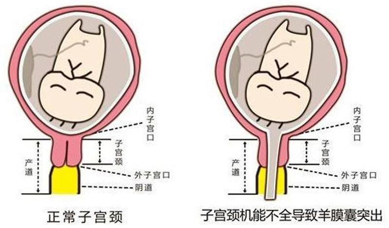 妇幼保健院三胞胎,妇幼保健院4胞胎