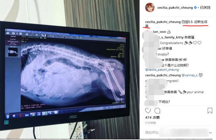 谢霆锋回应张柏芝三胞胎,张柏芝晒肚子隆起照引发猜测