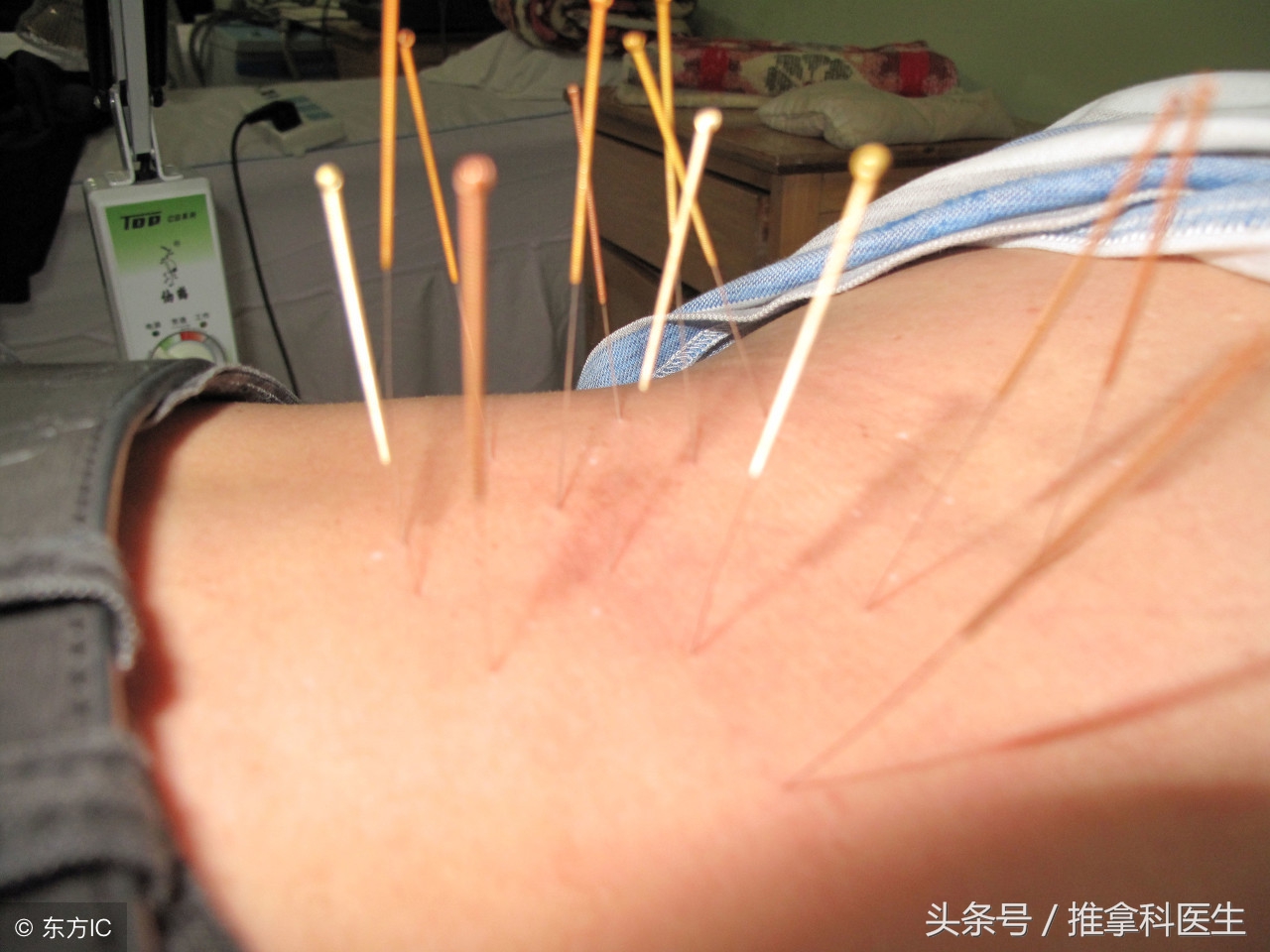 轻型腰椎间盘突出最佳治疗方法,腰突和椎间盘突出怎么治疗