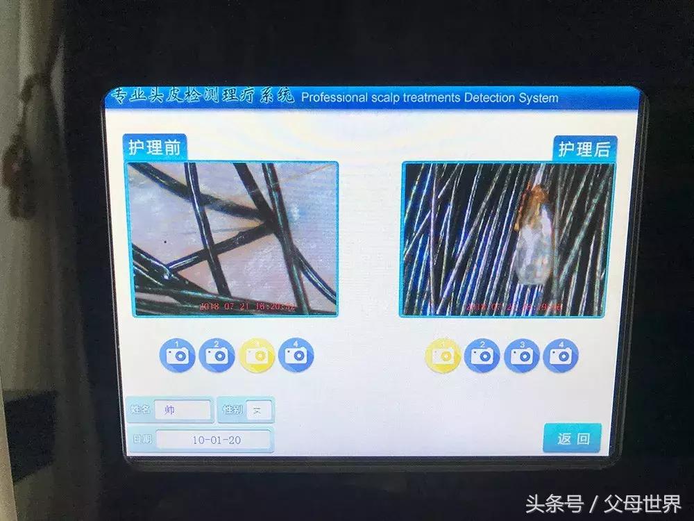 天天给女儿洗头，竟然还长了满头虱子！原因你也忽略过……