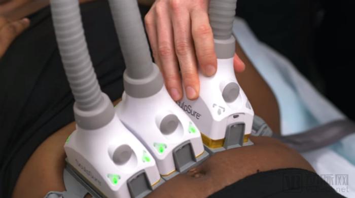 躺着不动就减肥的神器,胖子减肥有一种特效药