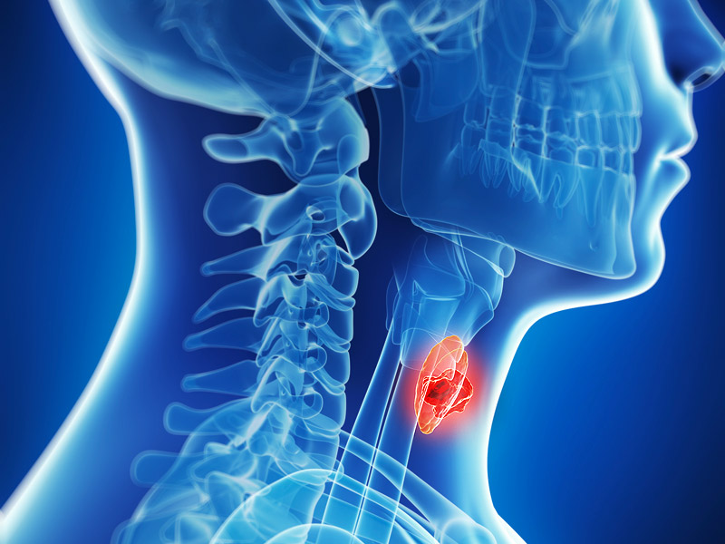 嗓子巨疼过敏,嗓子过敏咳嗽