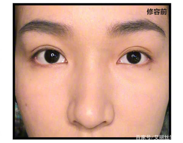 如何拯救肉鼻子,这样做立马从扁塌鼻变欧美高鼻梁!