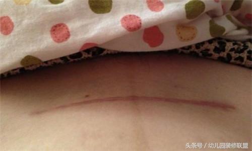 产后束腹带的正确使用方法和时间,产后束腹带如何正确使用