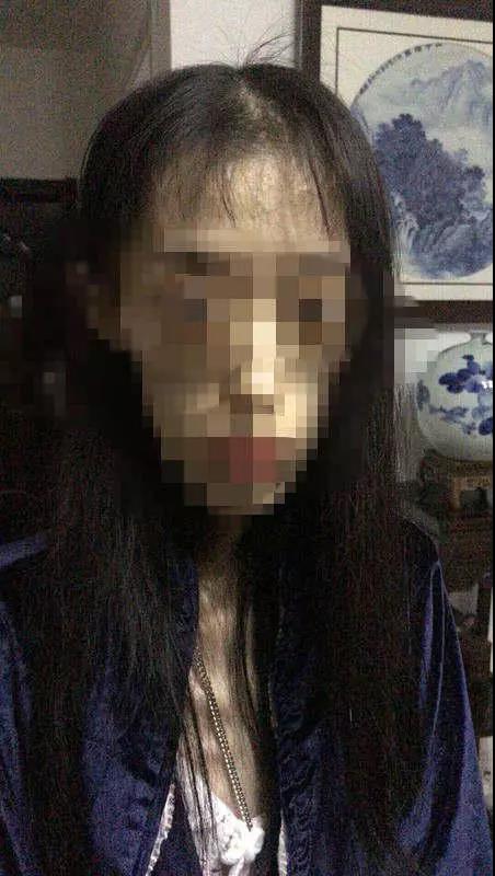 减肥导致脑出血的女子,杭州女子2周减肥10斤患脑梗死