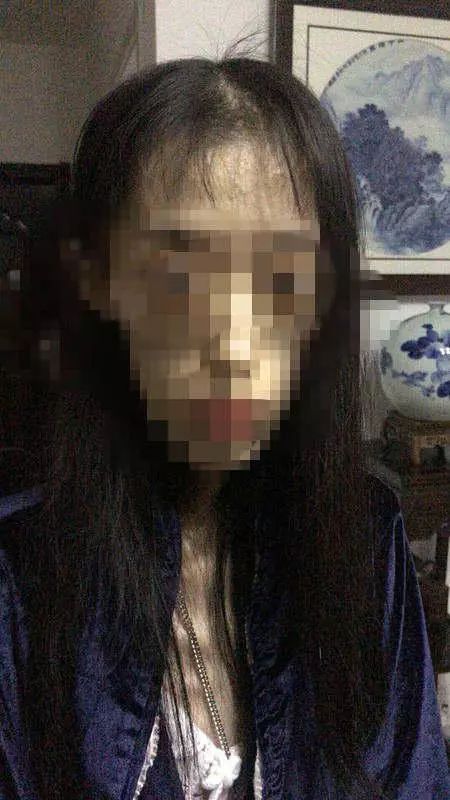 1米67才50斤!21岁女孩“自杀式减肥”,照片不忍直视……