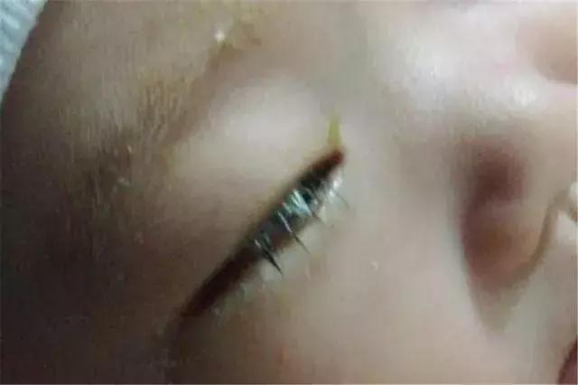 小孩吃了清火宝就一直哭怎么回事,小儿喝完清火宝后什么症状