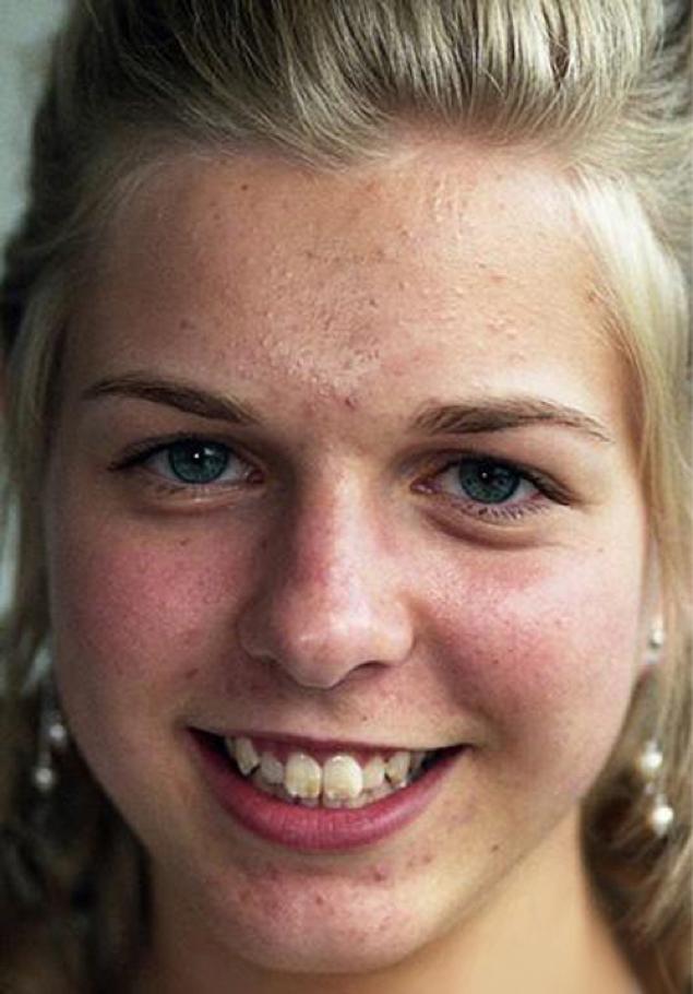 photoshop-利用通道给多斑的人磨皮（美到没朋友）