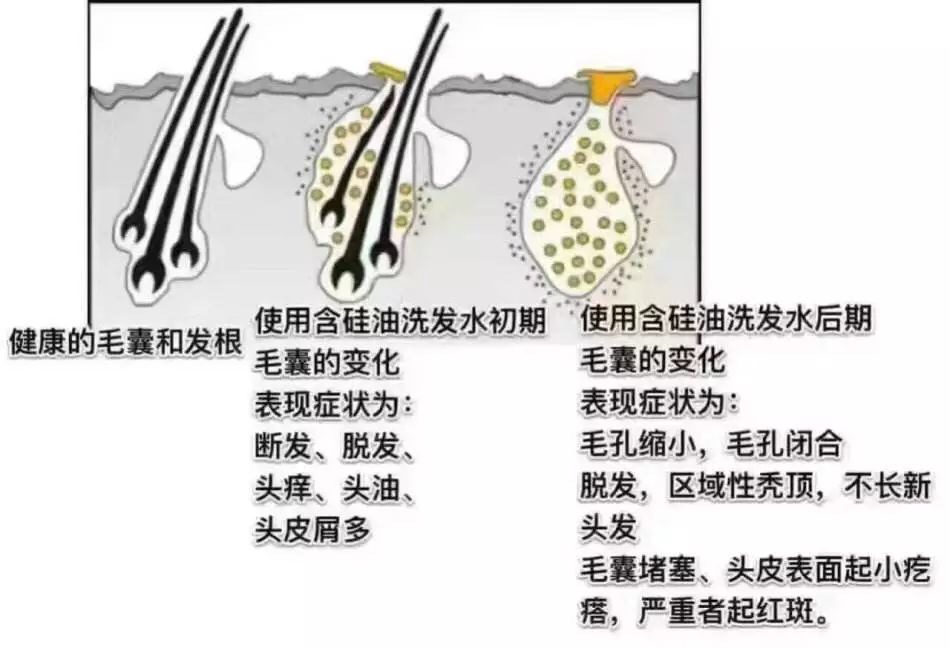 推荐一款大牌洗发水和护发水,除了洗发水还能用什么