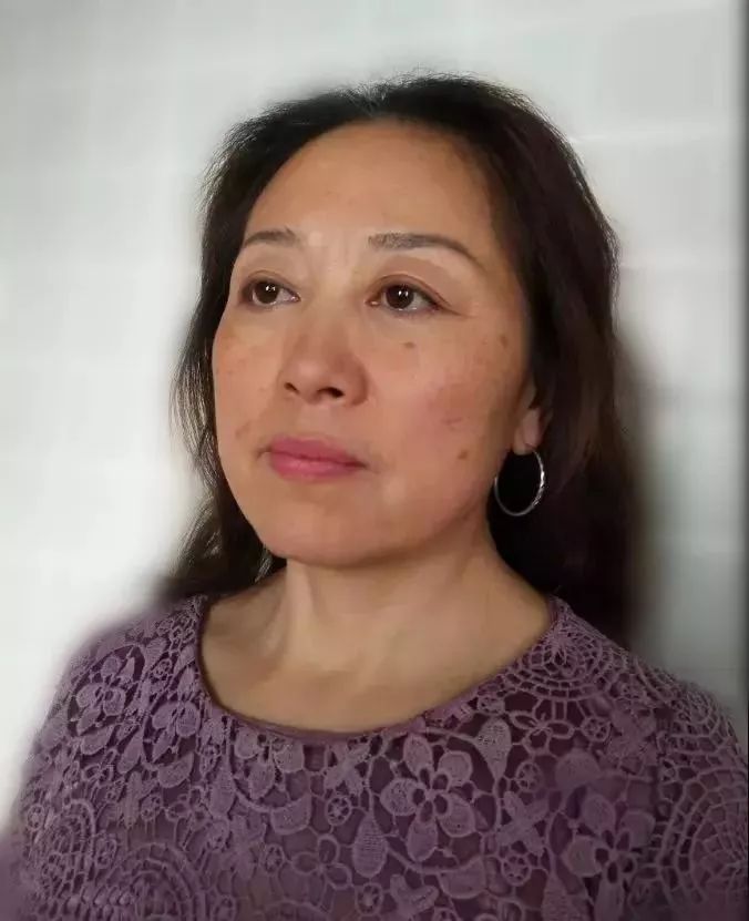 如何去除抬头纹法令纹鱼尾纹,一招改善抬头纹法令纹鱼尾纹