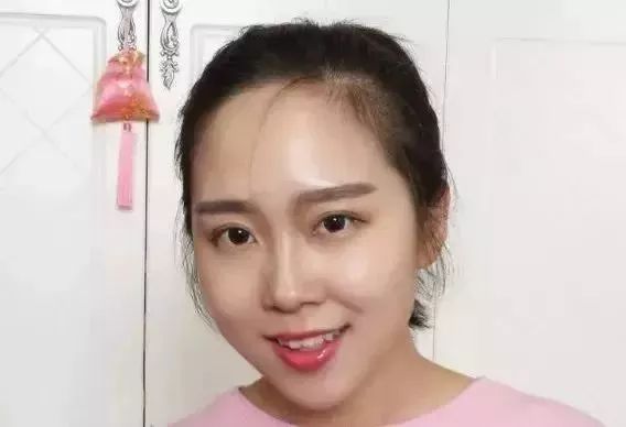 如何去除抬头纹法令纹鱼尾纹,一招改善抬头纹法令纹鱼尾纹