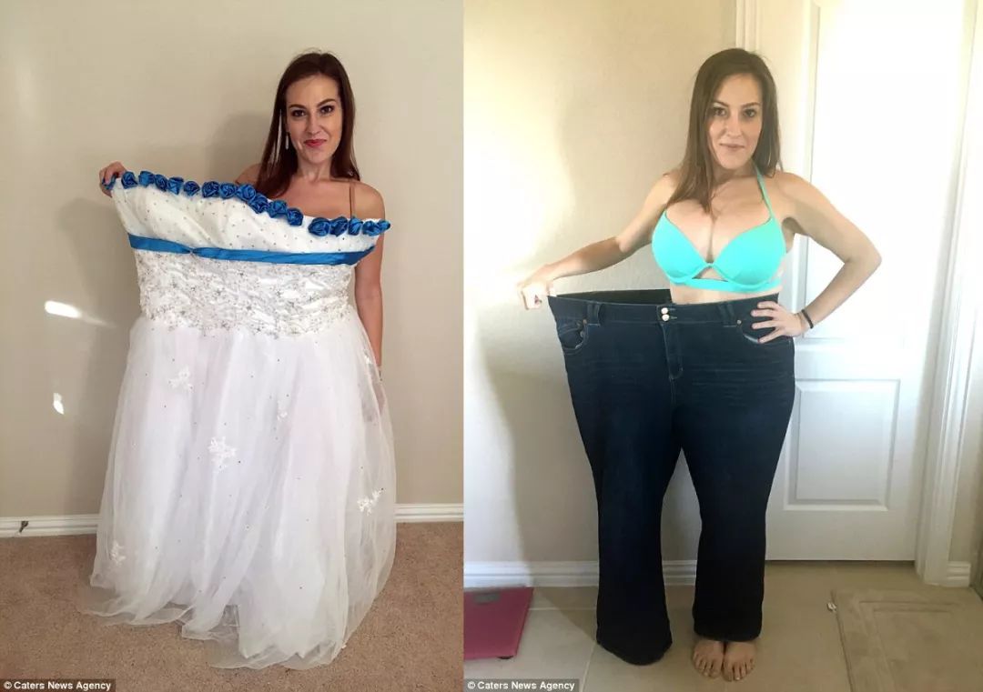 瘦了200斤，身体很多赘皮，怎么办？