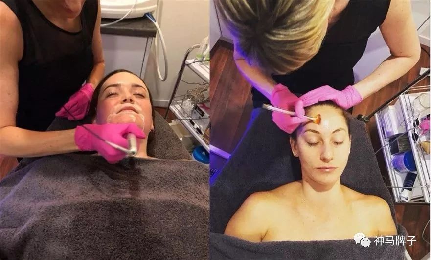 澳洲回国必买top10,去澳洲必买的10样东西