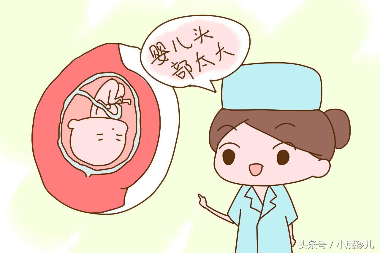 这3种情况的孕妈，剖腹产几率特别高，要早做准备才行