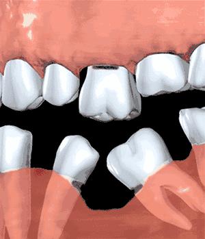 别让你的牙齿受罪,别让你的牙齿受委屈