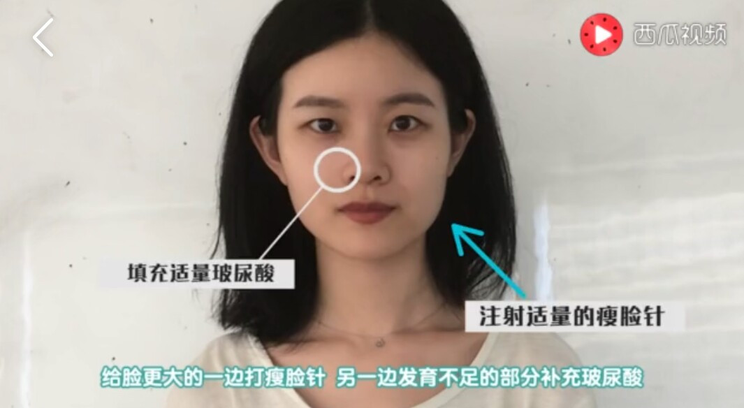 人脸歪了怎么调整,人脸是歪的怎么办