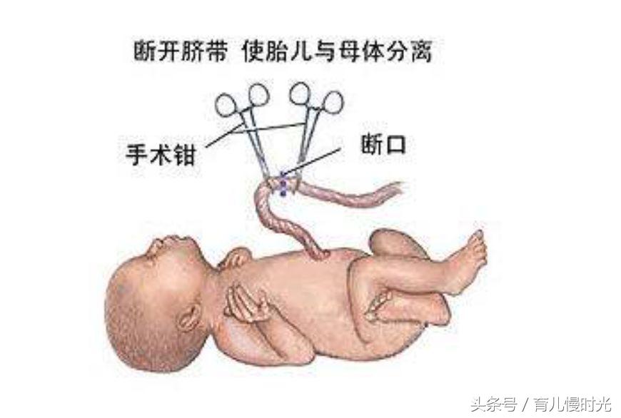 新生儿脐带护理有什么讲究,脐带消毒酒精好还是碘伏好