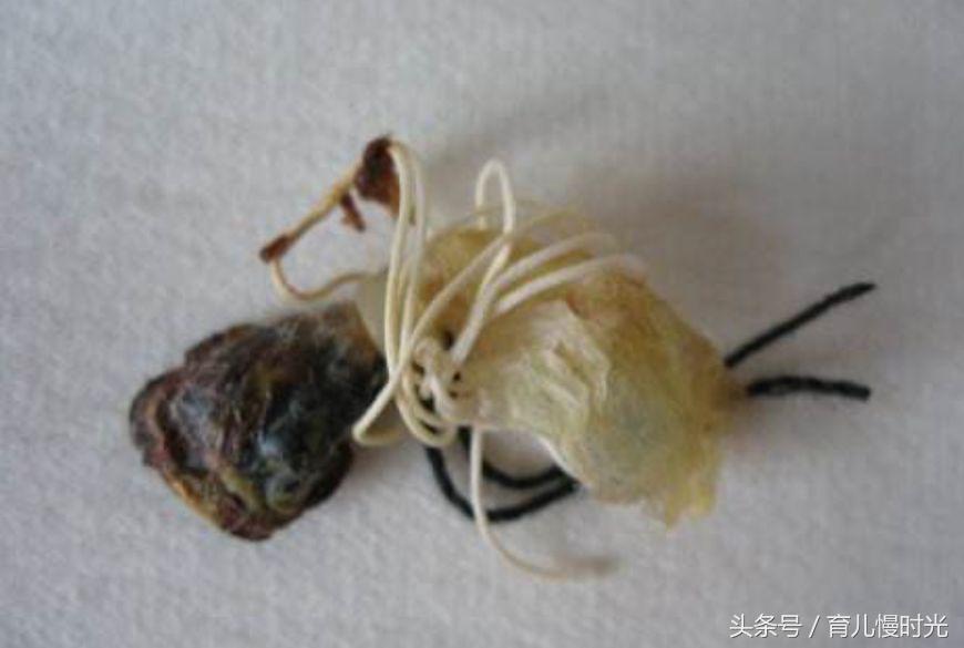 新生儿脐带护理有什么讲究,脐带消毒酒精好还是碘伏好