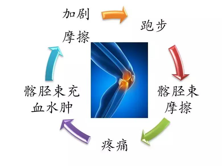 跑者”专利”：一文看懂膝外侧疼痛如何解决