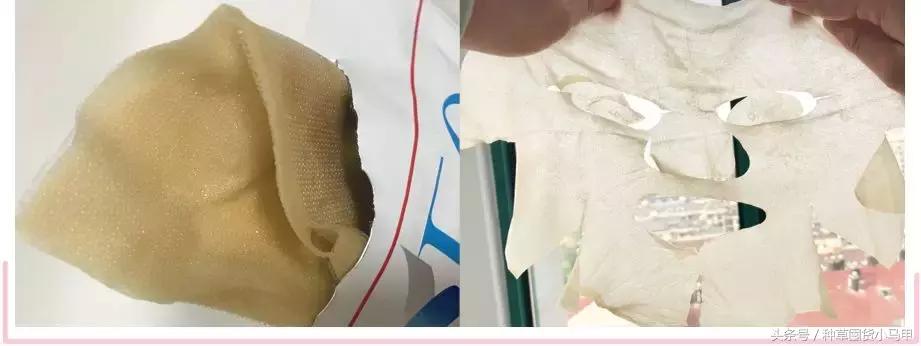 朋友圈狂推的“十项全能”医美面膜,用不对烂脸更严重!