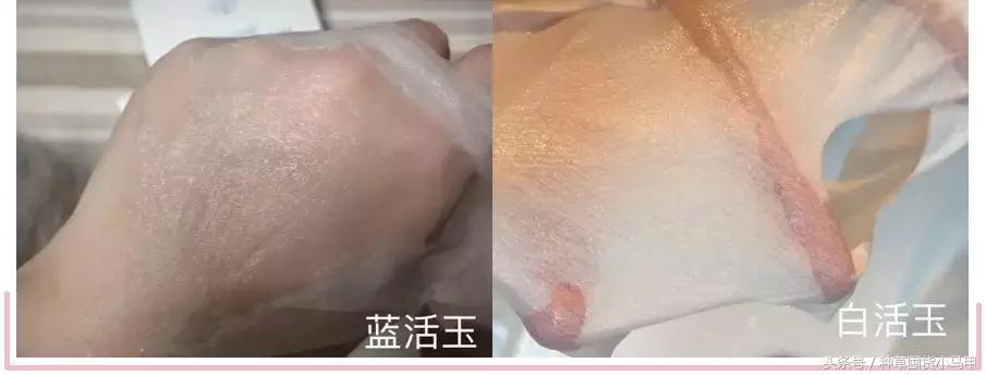 朋友圈狂推的“十项全能”医美面膜,用不对烂脸更严重!