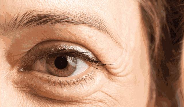 濡備綍鎷ユ湁鐑反鐨勫ぇ鐪肩潧,鐑反鐪肩潧閫犲瀷