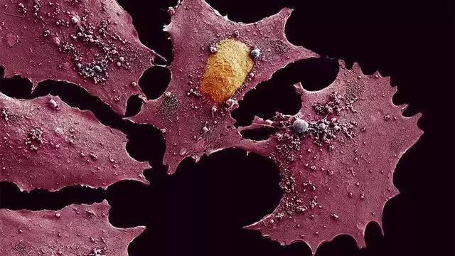 廉价解酒药居然是抗癌神药，死亡率极大降低！医学界炸锅了……