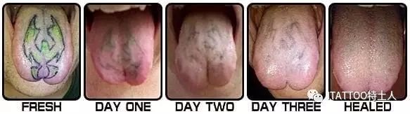 舌头上的刺青,舌头上可以刺青吗