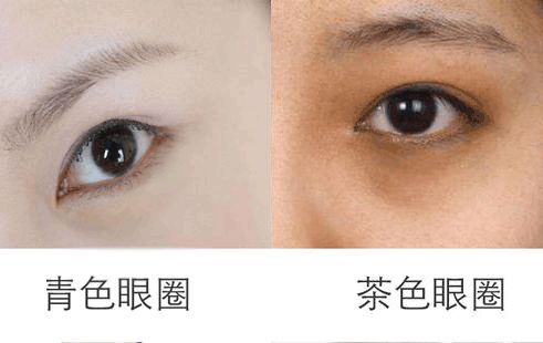 漂亮的人都睡了，用天价护肤品的你却毁容了！