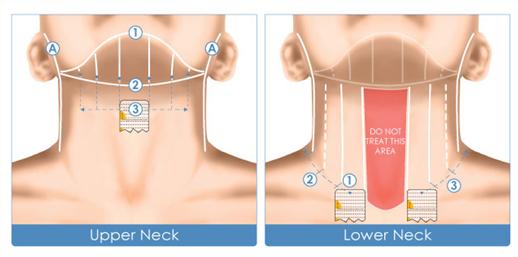 超声刀后没忌口的后果,超声刀做完禁忌