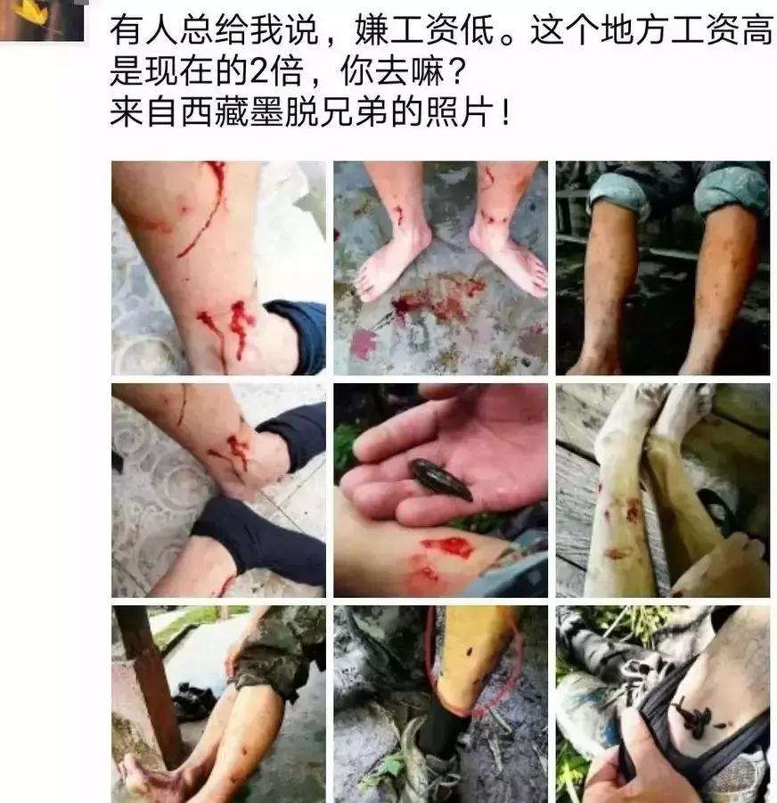 我的4个战友，3双眼睛1条腿！军人不怕牺牲怕遗忘