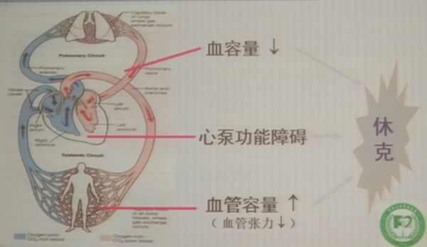 急性心肌梗死心律失常急救,急性心律失常的急救措施