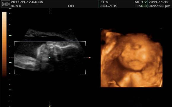 怀孕5-8周孕妈妈注意事项,怀孕29周的胎宝宝注意事项