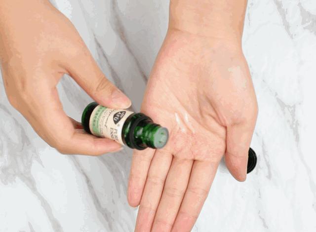 精油治痘痘,痘痘肌适合什么精油