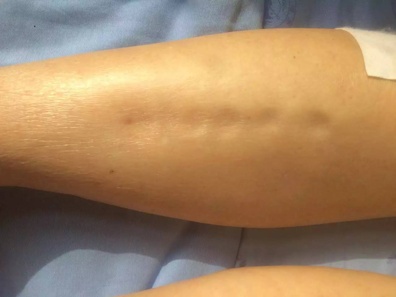 短效避孕药妈富隆和优思明哪个好,避孕短效药达英和优思明哪个好