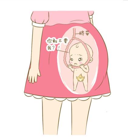 胎宝宝脐带绕颈别担心,孕妈妈可以这样做!